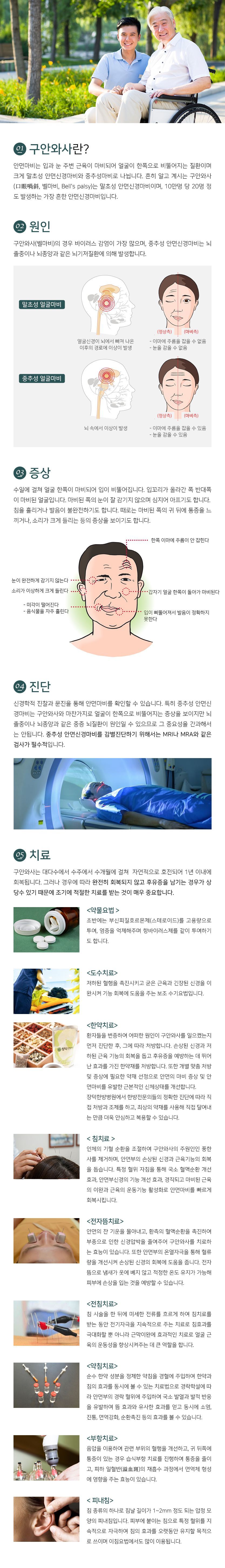 구안와사