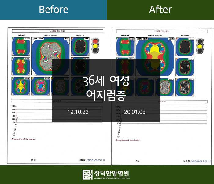 수술후기 이미지