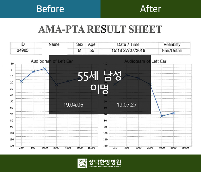 수술후기 이미지