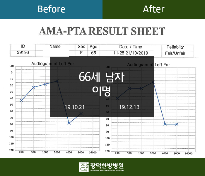 수술후기 이미지