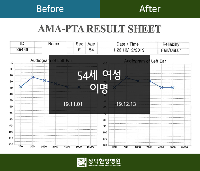 수술후기 이미지