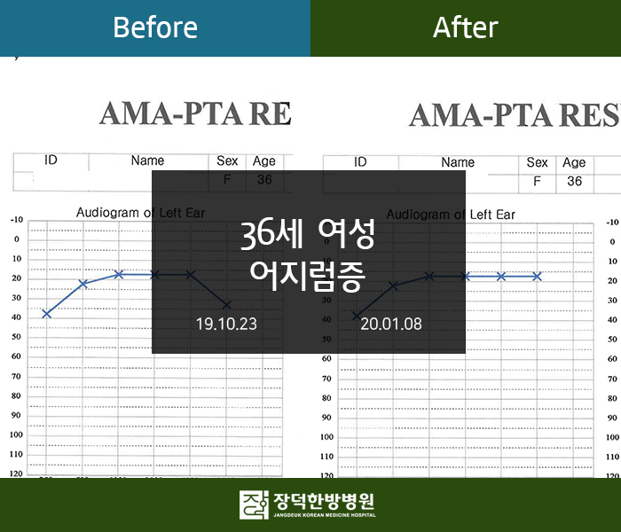 수술후기 이미지