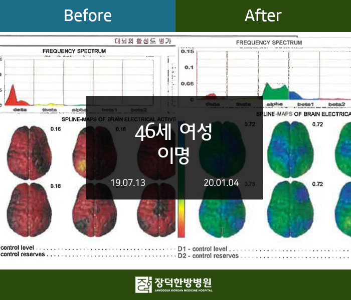 수술후기 이미지