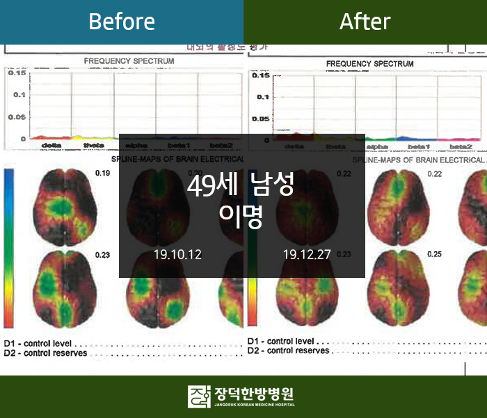 수술후기 이미지