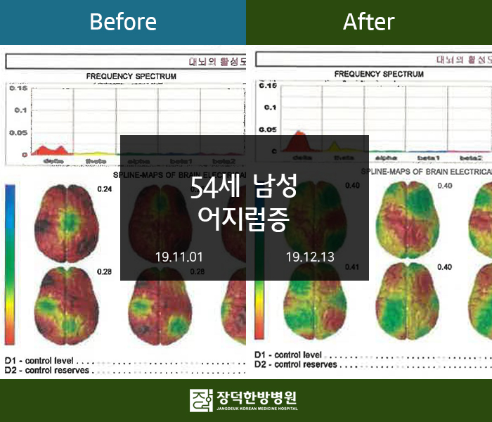 수술후기 이미지