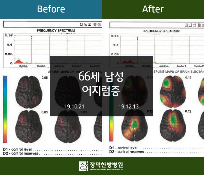 수술후기 이미지