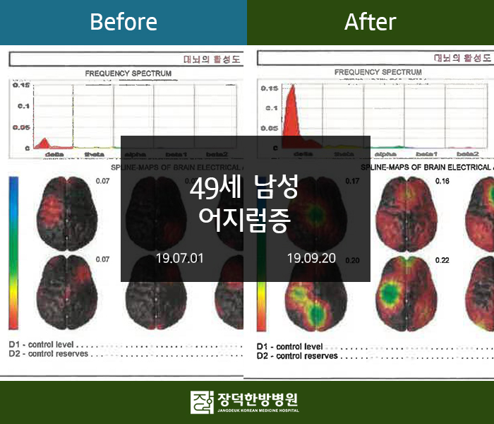 수술후기 이미지