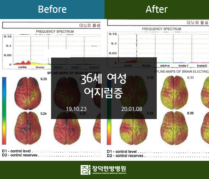 수술후기 이미지