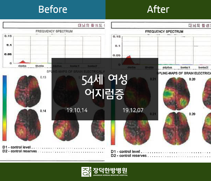 수술후기 이미지